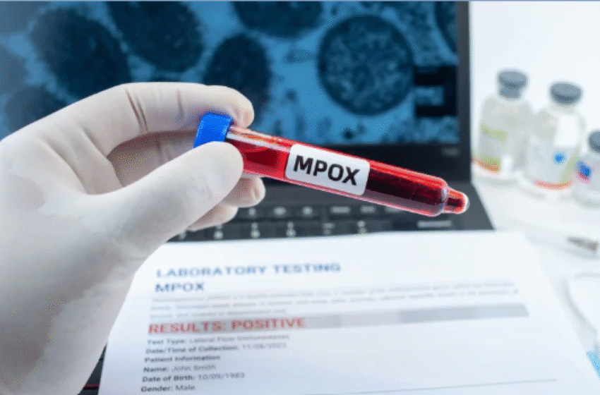  Mode de transmission, signes et mesures préventives : ce qu’il faut savoir sur le Mpox